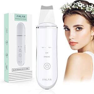 Anlan peeling ultrasónico